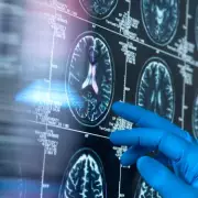 The 45p Superfood That Could Help Ward Off Dementia, According to Scientists