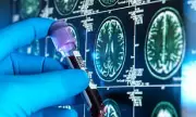 The Hidden Dementia Danger: Why Being 'Time-Poor' Could Be Damaging Your Brain Health