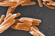 Tuberculosis Cases Surge in UK: Symptoms You Can't Ignore