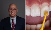 Unveiling Hollywood's Smile Secrets: The Truth About Celebrity Veneers and Their Staggering Costs