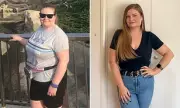 Woman Sheds 5 Stone With Mounjaro But Discovers Unusual Side Effect - Her Simple £8 Fix