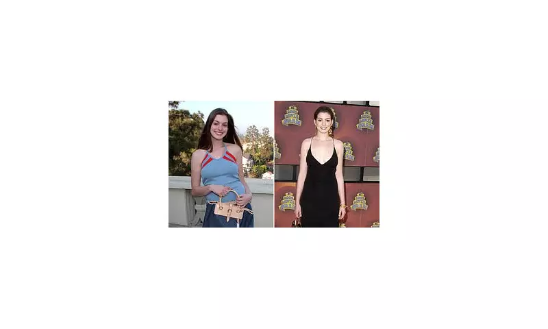 AI Reveals What Anne Hathaway Might Look Like Without Suspected Surgery