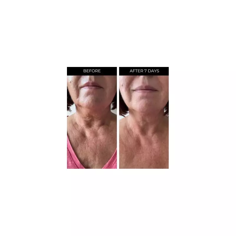 Beauty Bargain: This £18 Neck Serum Is Making Wrinkles and Sagging Skin Disappear