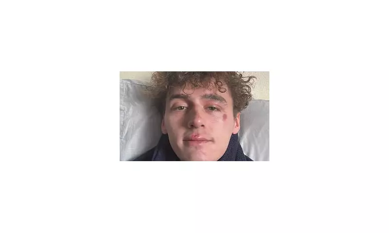 Big Brother Winner Cameron Cole Reveals Shocking Homophobic Attack Left Him With Black Eye