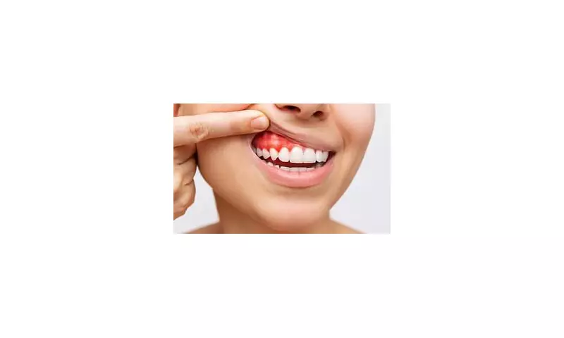 Dentist Reveals 6 Sinister Plaque Symptoms Threatening Your Smile