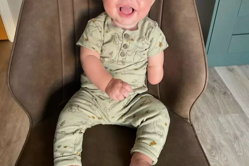 Miracle Baby Ezra Defies All Odds After Rare Amniotic Band Syndrome Diagnosis