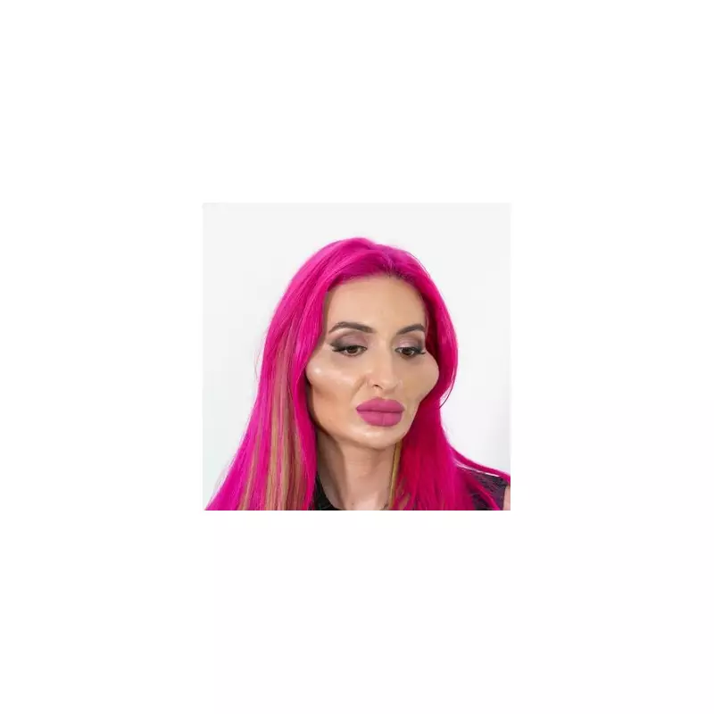 Model with 'world's biggest cheeks' shares rare pre-filler snap