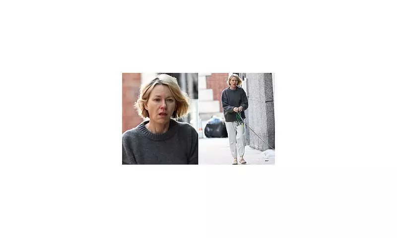 Naomi Watts Spotted in NYC After Ex Liev Schreiber's Hospital Scare
