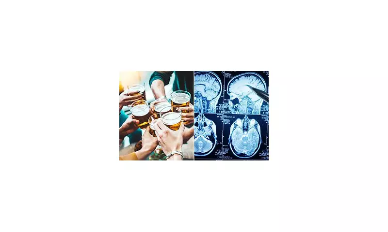 New Health Alert: Heavy Drinking Before 40 Significantly Raises Risk of Severe Strokes, Study Reveals