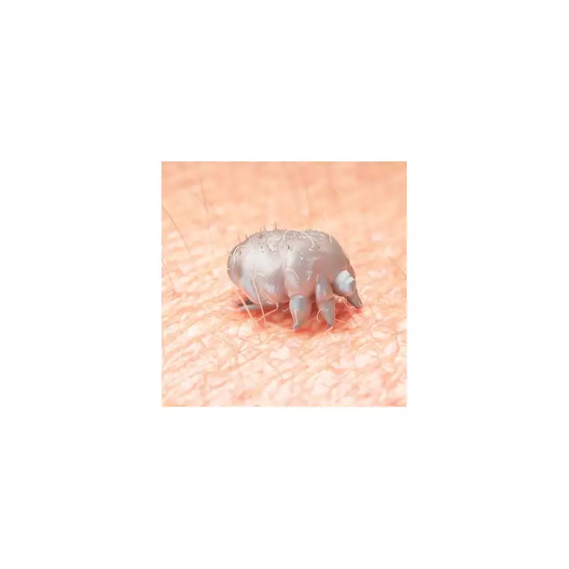 Scabies Crisis Sweeps UK: Skin Parasite Cases Surge 300% as Treatments Run Short