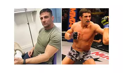 Alex Reid Hospitalised with Suspected Brain Bleed After Punch Drunk Symptoms