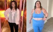 Amy Tapper Reveals Surgery Plan After 8-Stone Weight Loss with Mounjaro