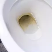 Banish Limescale Stains Forever: The 79p Kitchen Ingredient That Transforms Your Toilet