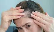 Claw Clip Hair Trend Causes Surge in Female Baldness, Warns Trichologist