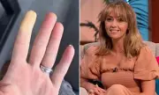 Coronation Street's Samia Longchambon Reveals 20-Year Raynaud's Battle