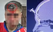 Footballer Stabbed with Car Key in Forehead at Youth Match in Argentina