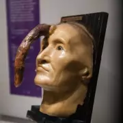 Human Horns Explained: The 25cm Growth and Skin Cancer Risks