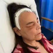 I Was Told My Symptoms Were 'Just A Head Cold' - It Was Actually A Silent Killer