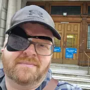 Man Hallucinated 'Baywatch Boobs' for 10 Days After Eye Surgery