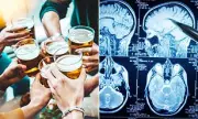 New Health Alert: Heavy Drinking Before 40 Significantly Raises Risk of Severe Strokes, Study Reveals