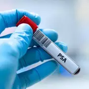 NHS Rejects Wider Prostate Cancer Screening for At-Risk Men