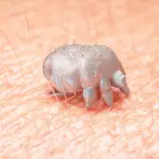 Scabies Crisis Sweeps UK: Skin Parasite Cases Surge 300% as Treatments Run Short