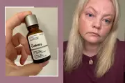 The Ordinary's 'Filler in a Bottle' Serum Tested: My Youthful Results at 40+