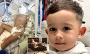 Toddler Suffers Severe Burns After Falling Into Tabletop Fire Pit During California Family Gathering