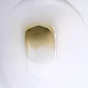 Toilet Limescale Removed in 24 Hours: 3 Methods Tested
