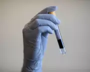 UK Prostate Cancer Screening Limited to High-Risk Genetic Groups