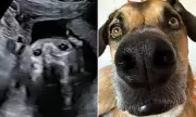 Ultrahound Revelation: Expectant Mother Stunned as Ultrasound Scan Shows Baby with Uncanny Canine Features