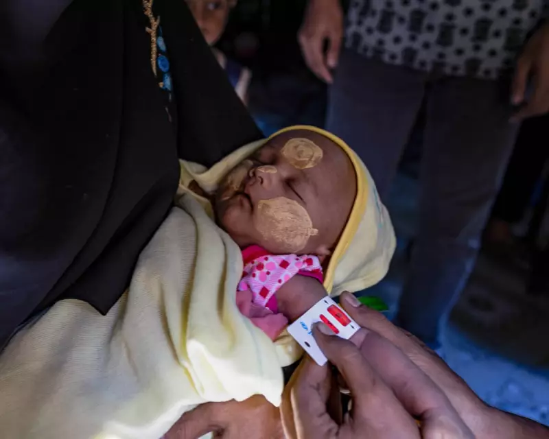 Cox's Bazar Crisis: Malnutrition Soars 11% as Rohingya Aid Plummets