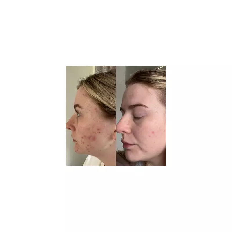 Yorkshire's 47 Skin Serum Boosts Confidence: 'No Longer Anxious in Photos'