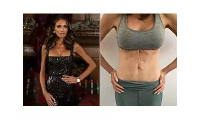 Amy Childs reveals non-surgical tummy transformation after four kids and weight loss