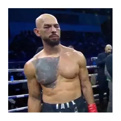 Andrew Tate's Gruesome Injury & Defeat to Chase DeMoor: Full Fight Breakdown