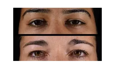 Can You Guess a Woman's Age From Just Her Eyes? Study Reveals Key Clues