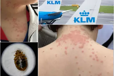 Family Sues KLM and Delta Over Bed Bug Nightmare on Transatlantic Flight