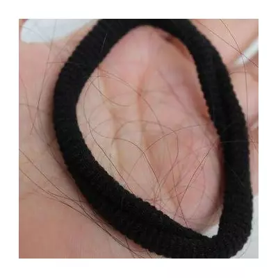 Hair Expert Warns: The Slicked-Back Bun Could Lead to Baldness