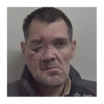 Kent burglar flees hospital with life-changing injury to commit more crimes