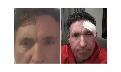 Liverpool Legend Robbie Fowler, 50, Reveals Skin Cancer Operation