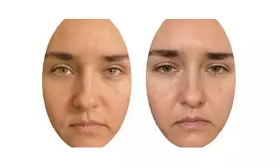 Women Excel at Spotting Hidden Signs of Illness in Faces, Study Reveals