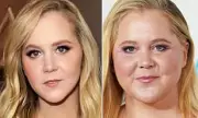 Amy Schumer's Dramatic Transformation: Weight Loss & Wrinkle-Free Face Spark Debate