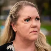 Car Crash Survivor's MRSA Nightmare: Infection 'Ate My New Face'