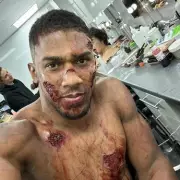 Driver in Anthony Joshua Crash Faces Reckless Driving Prosecution