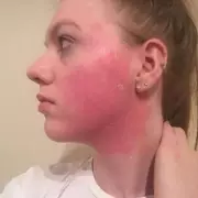 Ex-Boots Worker: 'I Wish I Had This £13 Spot Serum For My Teenage Acne'