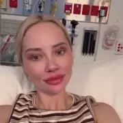 MAFS Star Jessika Power's Brother 'Lucky to Be Alive' After Christmas Injury