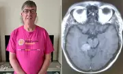Man's Tinnitus Led to Inoperable Brain Tumour Diagnosis After 2 Years