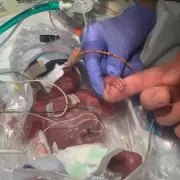 Miracle Baby Born at 22 Weeks, Weighing Just 1lb, Defies Odds to Go Home