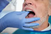New NHS Dentistry Reforms Aim to Save Patients Over £200