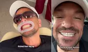Peter Andre's Teeth Chipped by Drunk Fan's Stage Kick, Reveals Agonising Ordeal